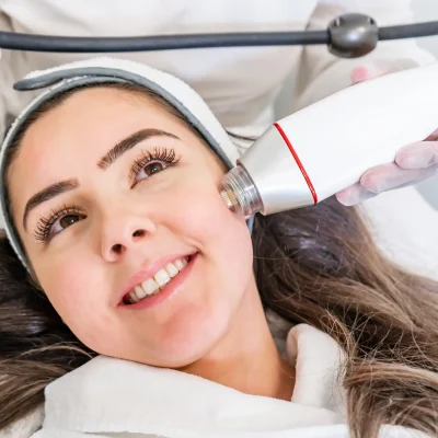 Morpheus8 RF Microneedling