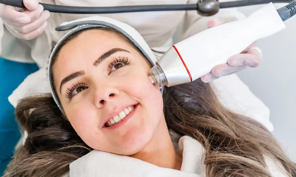 Morpheus8 RF Microneedling
