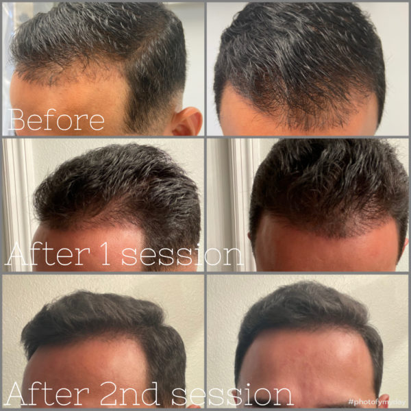 Gallery Rose Medical Aesthetics