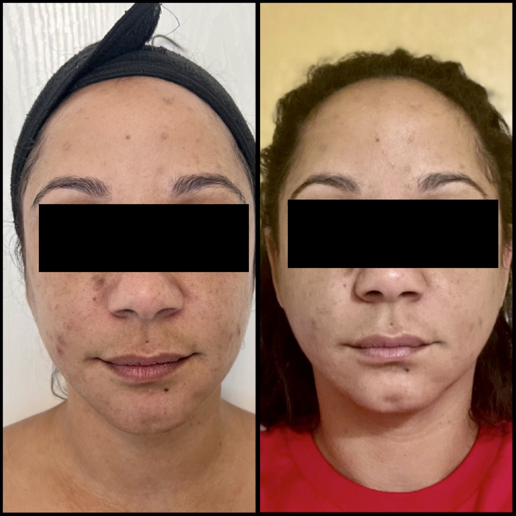 Gallery Rose Medical Aesthetics