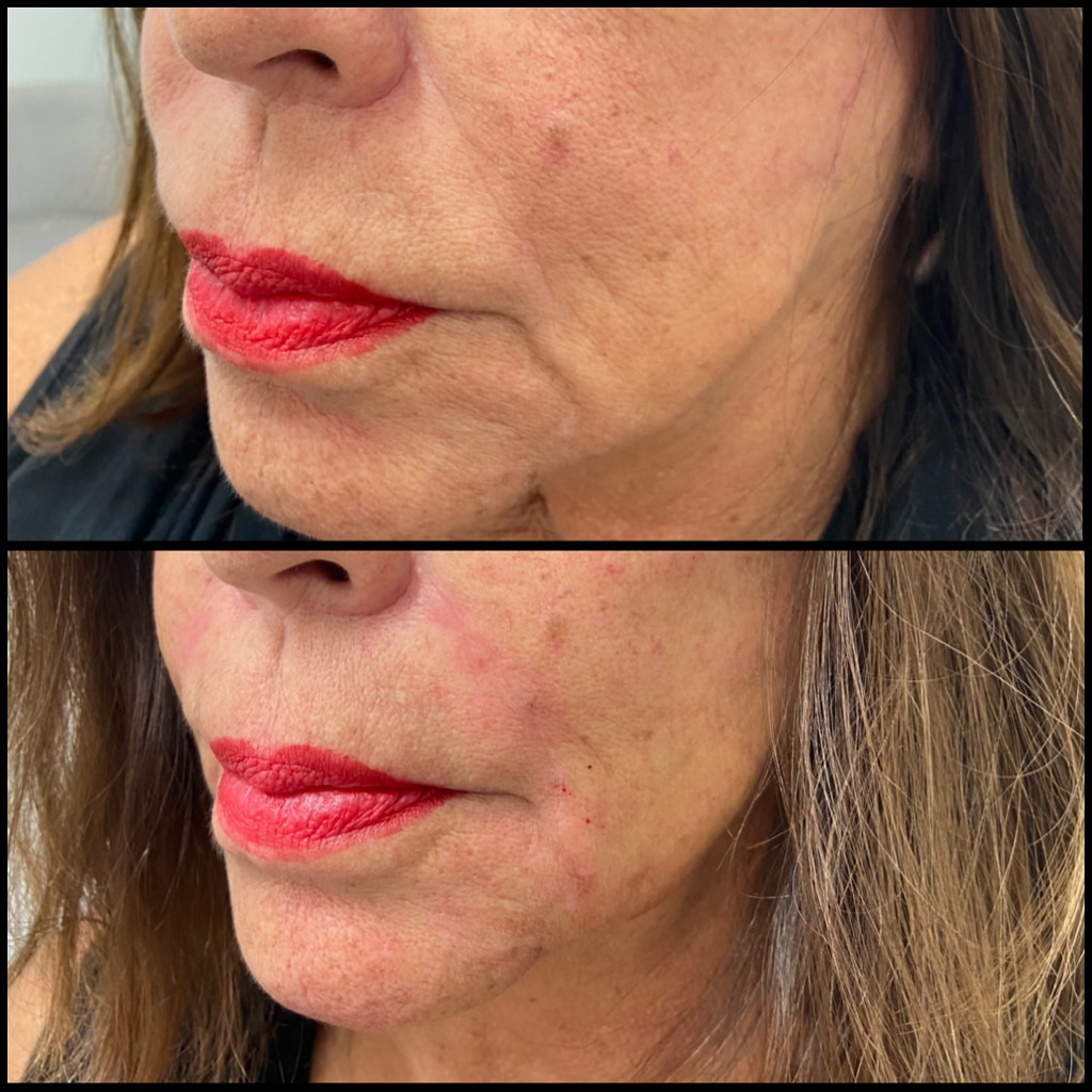 Gallery Rose Medical Aesthetics